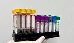 Скидка 25% на лабораторные анализы