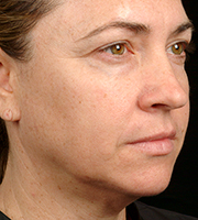 01_016-after-d.jpg 01_016-after-d.jpg