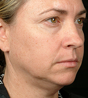 01_016-before-d.jpg 01_016-before-d.jpg