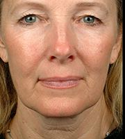 01_017-after-d.jpg 01_017-after-d.jpg