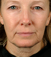 01_017-before-d.jpg 01_017-before-d.jpg