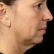 01_018-before-d.jpg 01_018-before-d.jpg