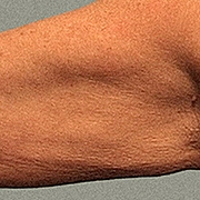 01_035-after-d.jpg 01_035-after-d.jpg