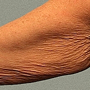 01_035-before-d.jpg 01_035-before-d.jpg