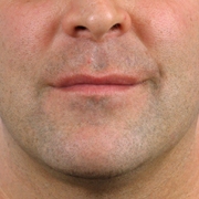 01_098-after-d.jpg 01_098-after-d.jpg