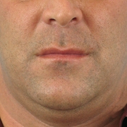 01_098-before-d.jpg 01_098-before-d.jpg