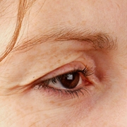 01_123-before-d.jpg 01_123-before-d.jpg